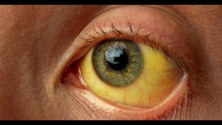 ۱۴۰۰ نکته هاریسون یرقان بخش اول       دکترعلی فلاحیان