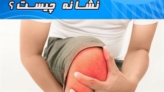 ورم مفصل نشانه چیست