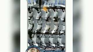 ایمپلنت دندان