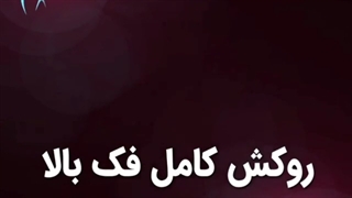 روکش کامل فک بالا