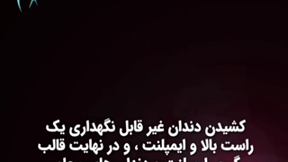کشیدن دندان و ایمپلنت