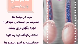 علائم شایع واریکوسل