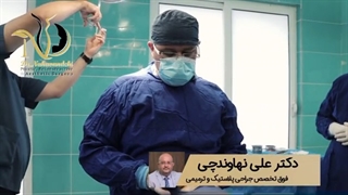 مراقبت های بعد از عمل بینی