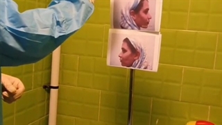 جراحی بینی کاملا گوشتی توسط دکتر اصحاب یمین اکستنشن تاج دندان