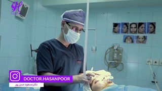 نحوه چسپ زدن بینی بلافاصله بعداز جراحی بینی