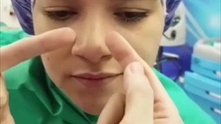 قبل و بعد از جراحی رینوپلاستی