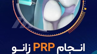 انجام پى آر پى زانو