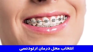 انتخاب محل درمان ارتودنسی | دکتر احسان مهریزی