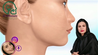 اول ارتودنسی کنیم یا عمل زیبایی بینی انجام دهیم؟