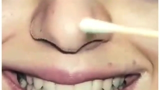 جراحی زیبایی بینی در اتاق عمل