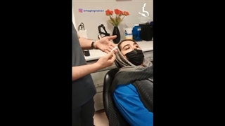 نحوه چسب زدن بینی بعد از عمل