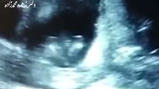 واکشن به خواندن آهنگ و دست زدن جنین در شکم مادر