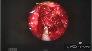 عمل مجدد کوردوما