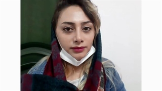 نتیجه عمل زیبایی بینی