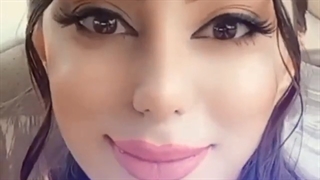 فیلم نتیجه جراحی زیبایی بینی