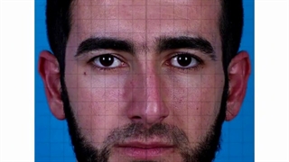 جراحی زیبایی بینی مردانه