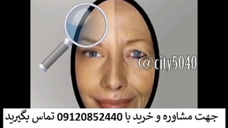 قیمت کرم ضد چروک صمیم 09120852440 جراحی گوش