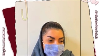 فیلم نتیجه کاشت ابرو بعد از 1 سال