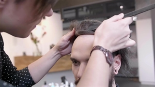 پروتز مو مردانه