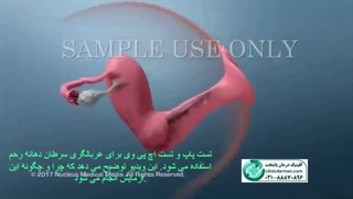 آزمایش اچ پی وی چگونه انجام میشود؟ clinicdarman.com