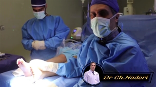 جراحی هالوکس والگوس چیست؟