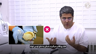 اسکن  دیجیتال  داخل دهانی چیست و چقدر طول می کشد؟