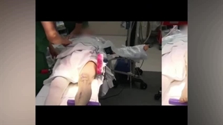 نگهدارنده پا مخصوص تعویض مفصل زانو