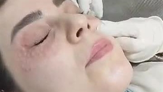 مزوژل جالپرو یانگ آی در فردیس