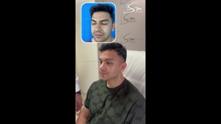 تجمیل الأنف، رفع الحاجب بالمنظار، الدهون الخدیة