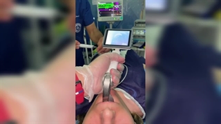 نکته مهم حین لارنگوسکوپی