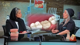 مقایسه روش های نوین و سنتی پر کردن دندان