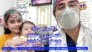 بهترین روش ختنه؟ حلقه؟ لیزر؟ سنتی؟