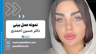 دکتر حسین احمدی متخصص عمل بینی در کرج - پزشک 24