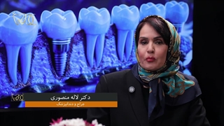 نقش عوامل روحی در سلامت دندان‌ها